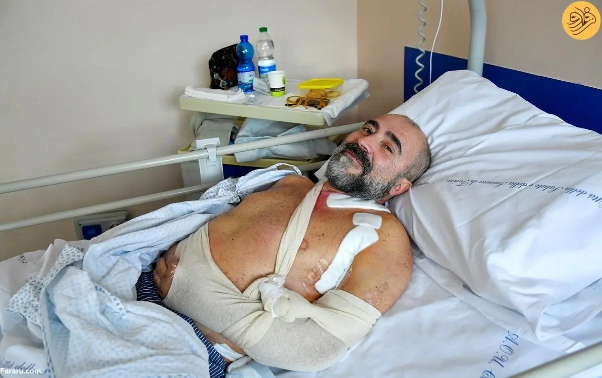 (ویدئو 16+)  پیوند بخشی از عصب پای یک مرد تصادف کرده به دستش