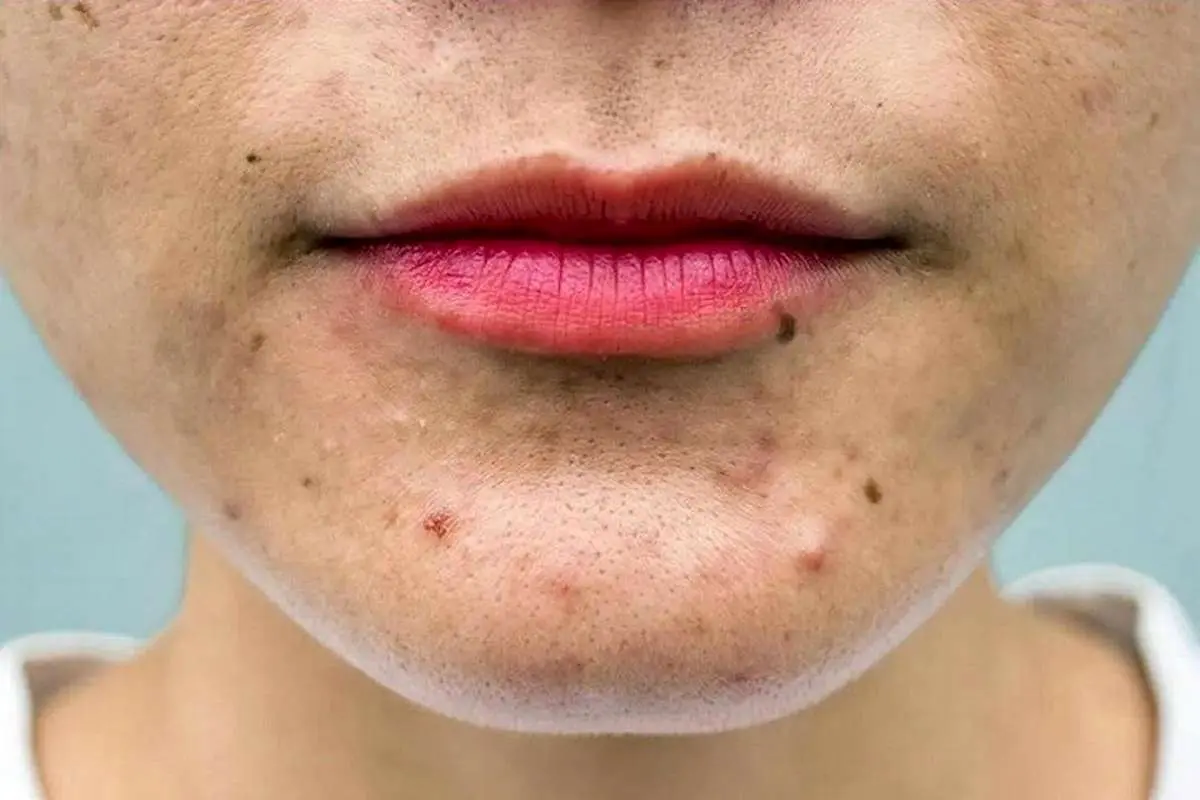 چیزهای عجیبی که نمیدانستید به پوست صدمه میزنند