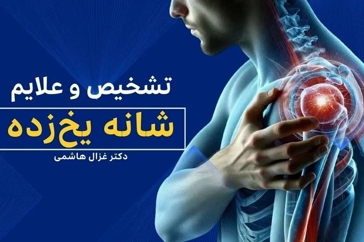 آیا درمان «شانه یخ‌زده» یک تا سه سال زمان می برد؟