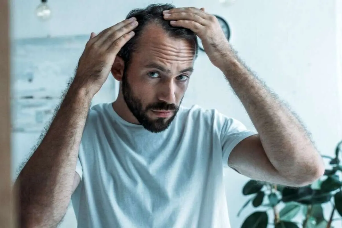 چرا زندگی مدرن باعث ریزش مو‌های مردان می‌شود و چگونه از آن جلوگیری کنیم؟