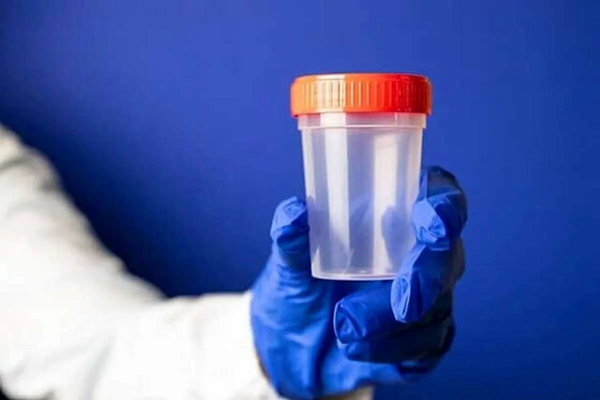 رنگ ادرار در مورد سلامتی شما چه می‌گوید