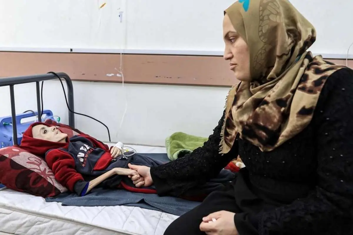 (ویدئو) کودک فلسطینی تبدیل به اسکلت شد و جان باخت