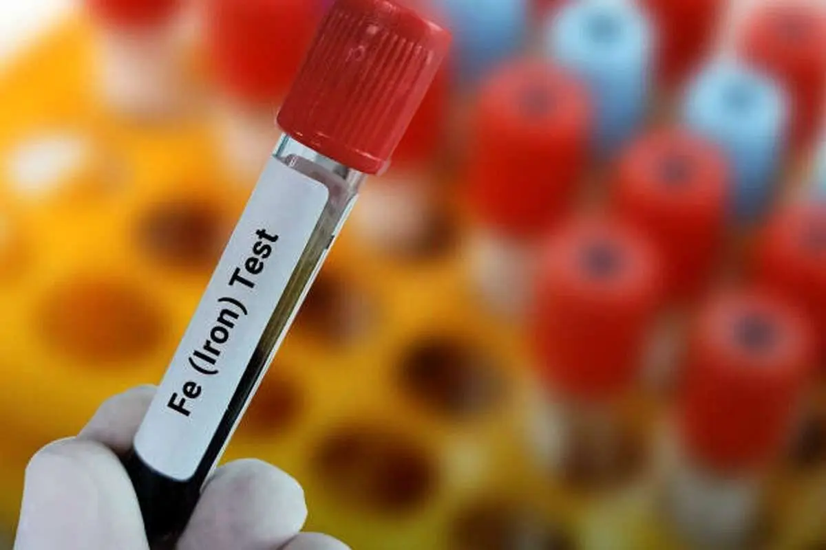 کمبود آهن عاملی برای ابتلا به کووید طولانی