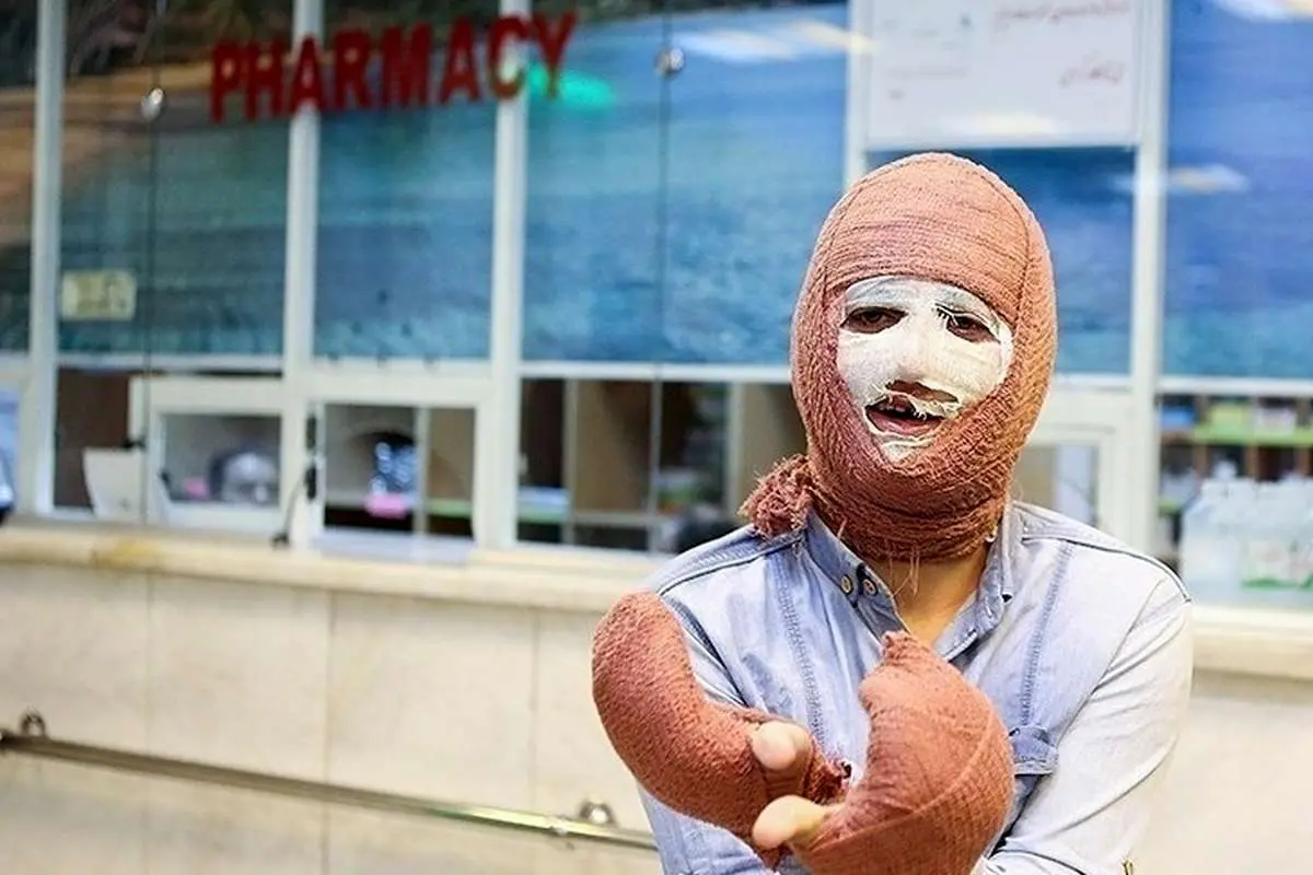 (ویدئو)روایت تلخ جوان تبریزی از انفجار مواد محترقه