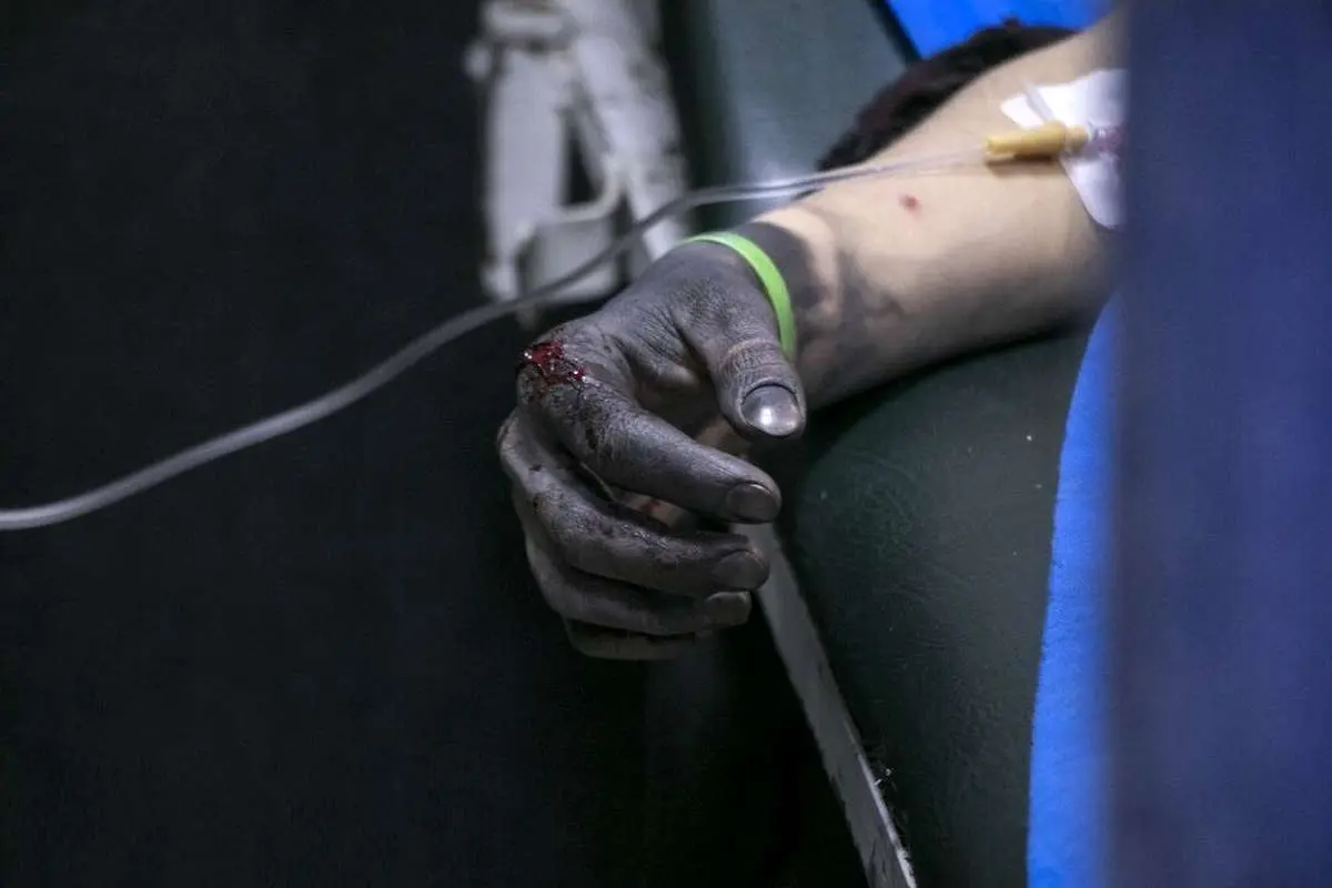 انفجار نارنجک چهارشنبه‌سوری، انگشتان پاکبان تهرانی را قطع کرد