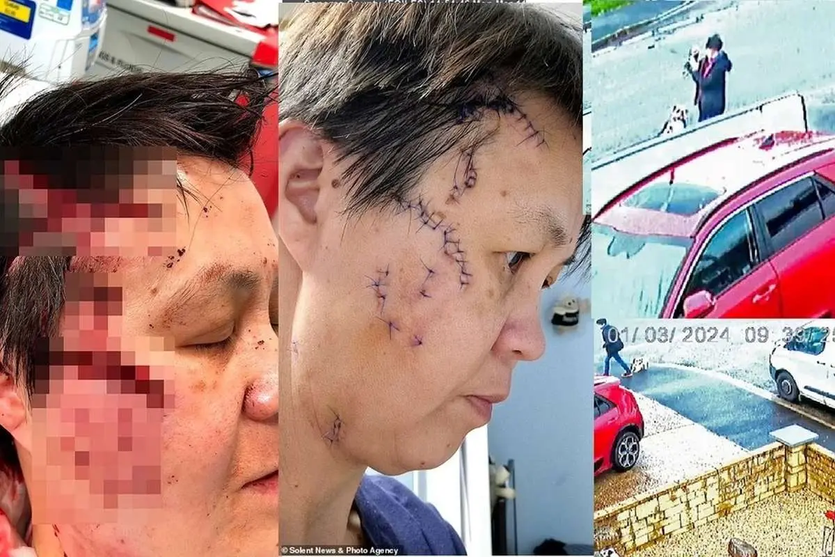 (ویدئو) حمله وحشتناک سگ روتوایلر به یک زن