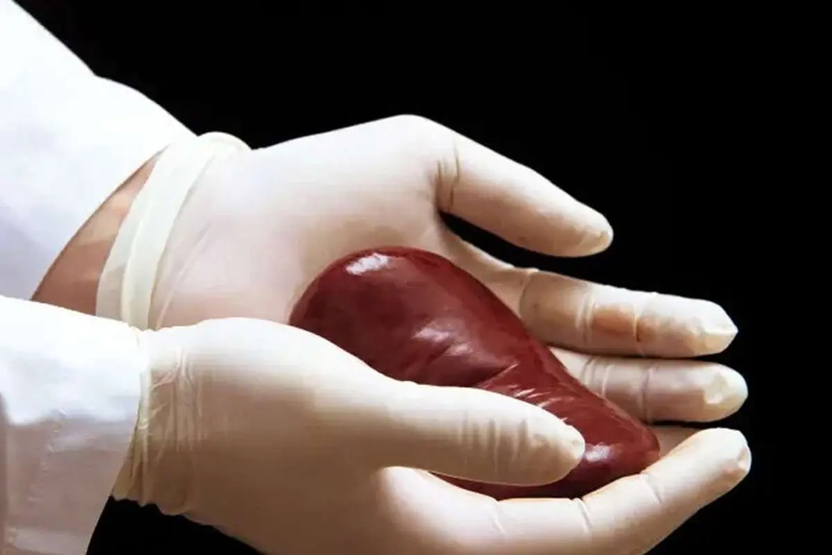 (عکس) زنی که یکی از چهار کلیه‌اش را می‌فروشد