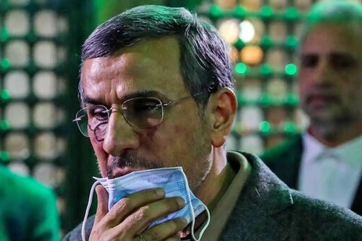 ماجرای رأی لحظه آخری احمدی نژاد بعد از عمل جراحی پلک