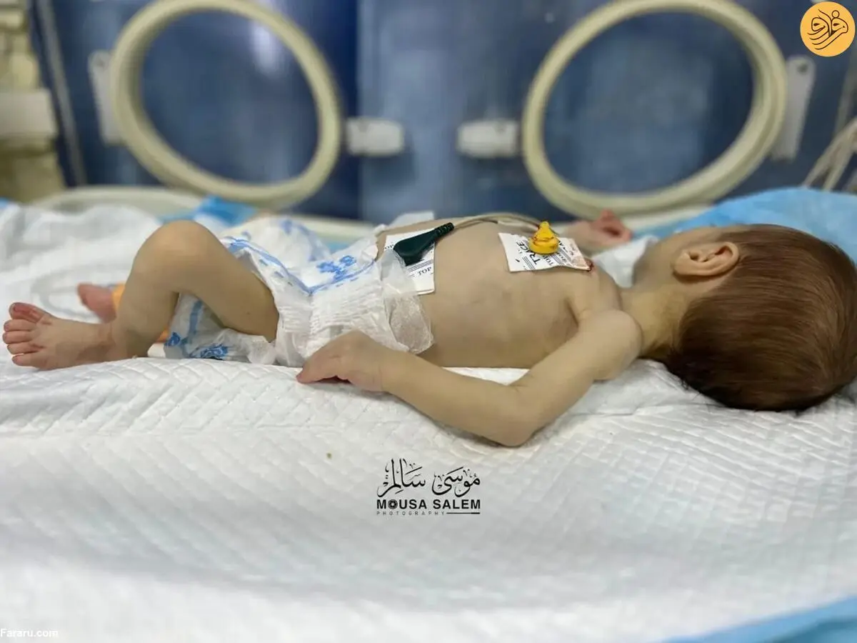 (ویدئو) داستان لیلا؛ روایت مبارزه نوزادان فلسطینی با سوءتغذیه در غزه