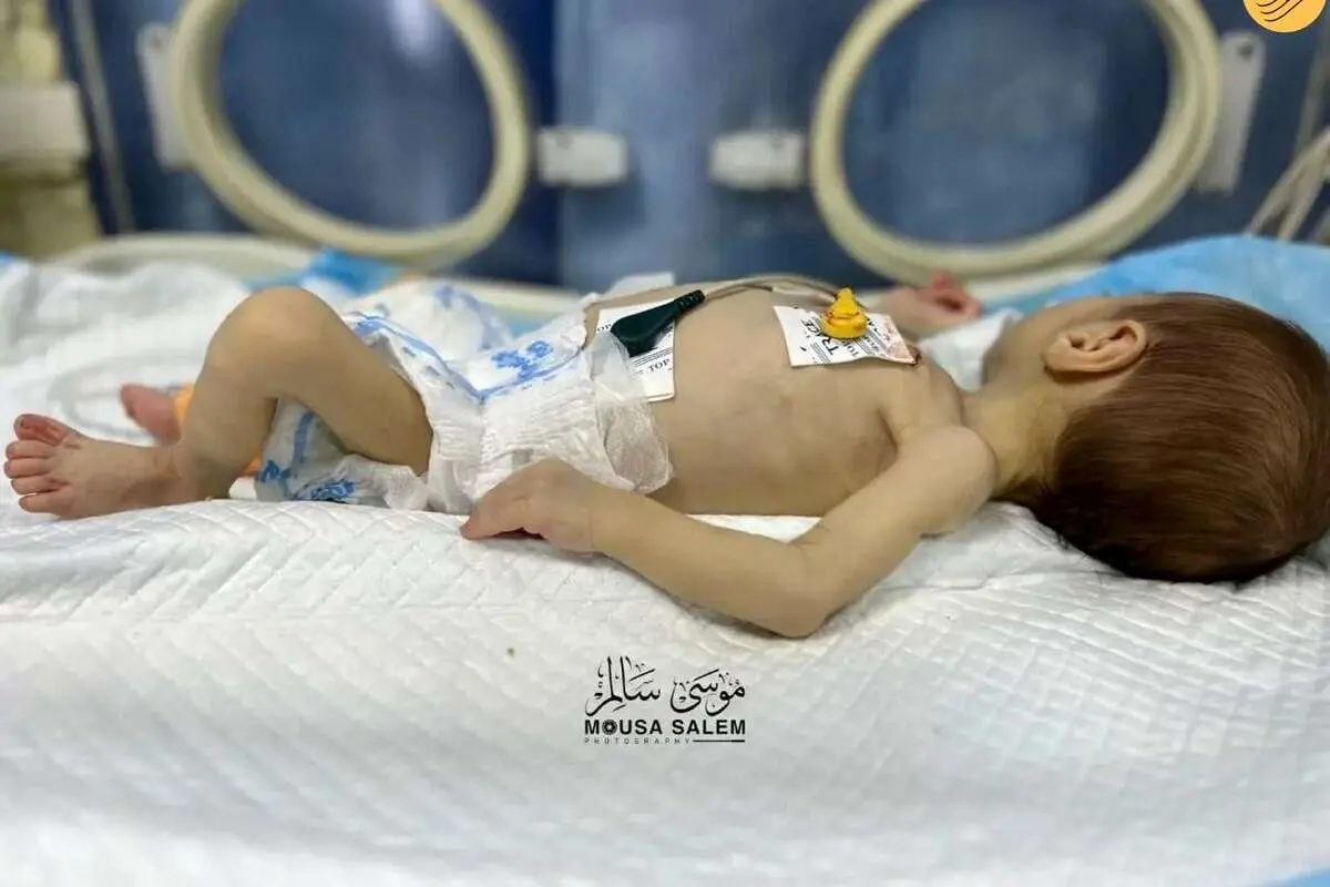 (ویدئو) داستان لیلا؛ روایت مبارزه نوزادان فلسطینی با سوءتغذیه در غزه