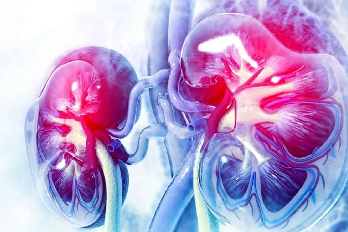 کشف روش‌های درمانی بالقوه بیماری کلیه پلی‌کیستیک