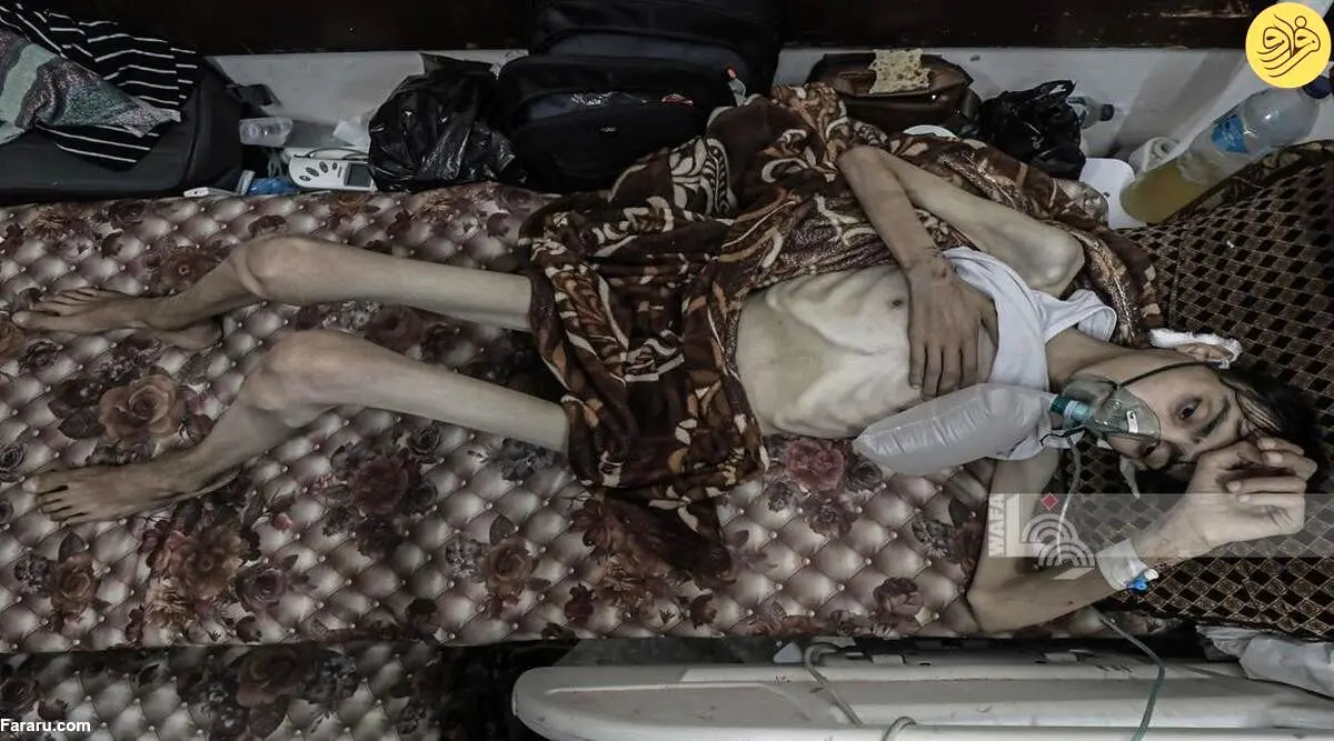 (ویدئو) وضع غم‌انگیز جوان فلسطینی پس از جنگ در غزه