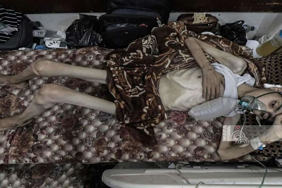 (ویدئو) وضع غمانگیز جوان فلسطینی پس از جنگ در غزه