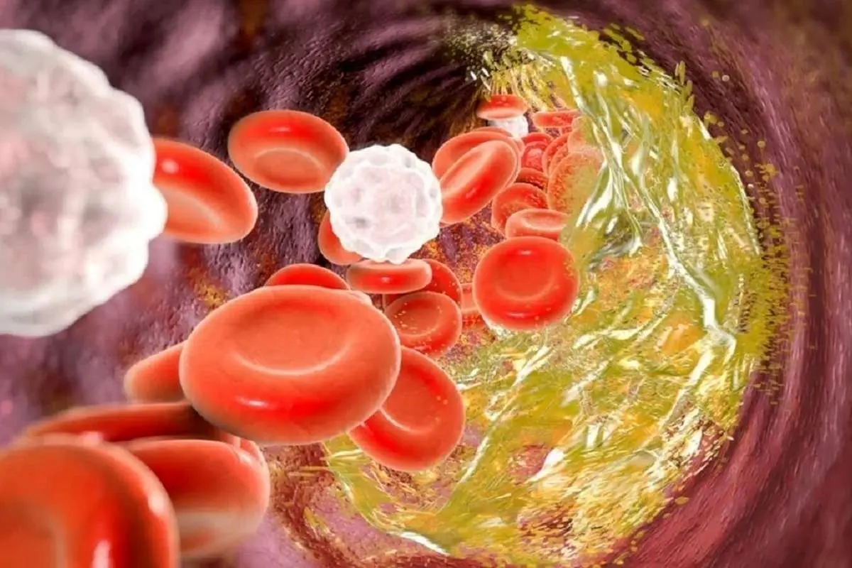 استرس چگونه باعث تغییر کلسترول خون می‌شود؟