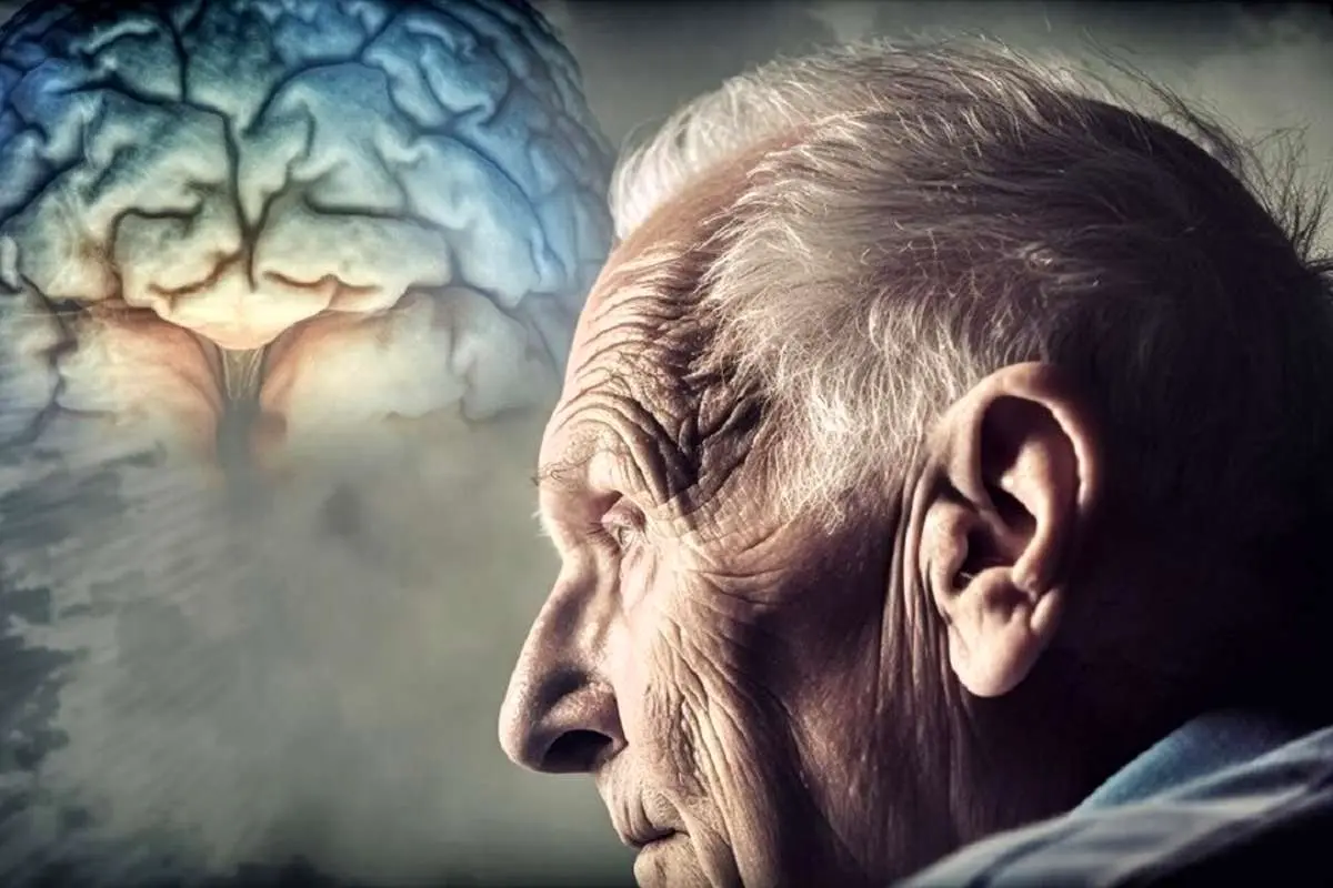 شناسایی راهکار موثر برای کنترل آلزایمر