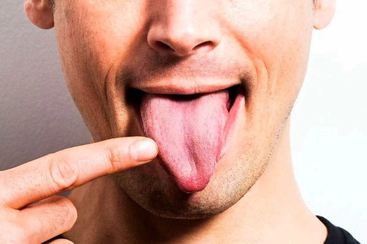 زبانتان در مورد سلامتی شما چه می‌گوید؟