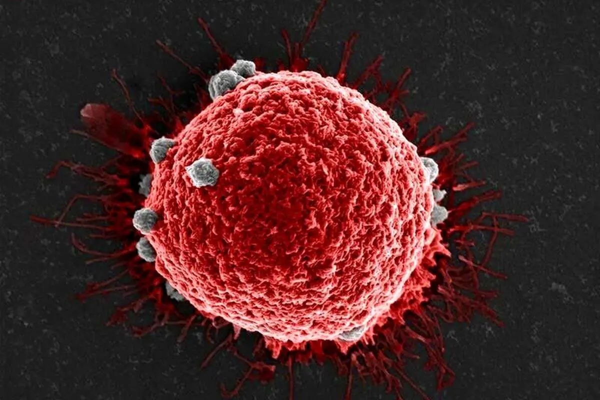 مشاهده این نشانه در بدن را جدی بگیرید