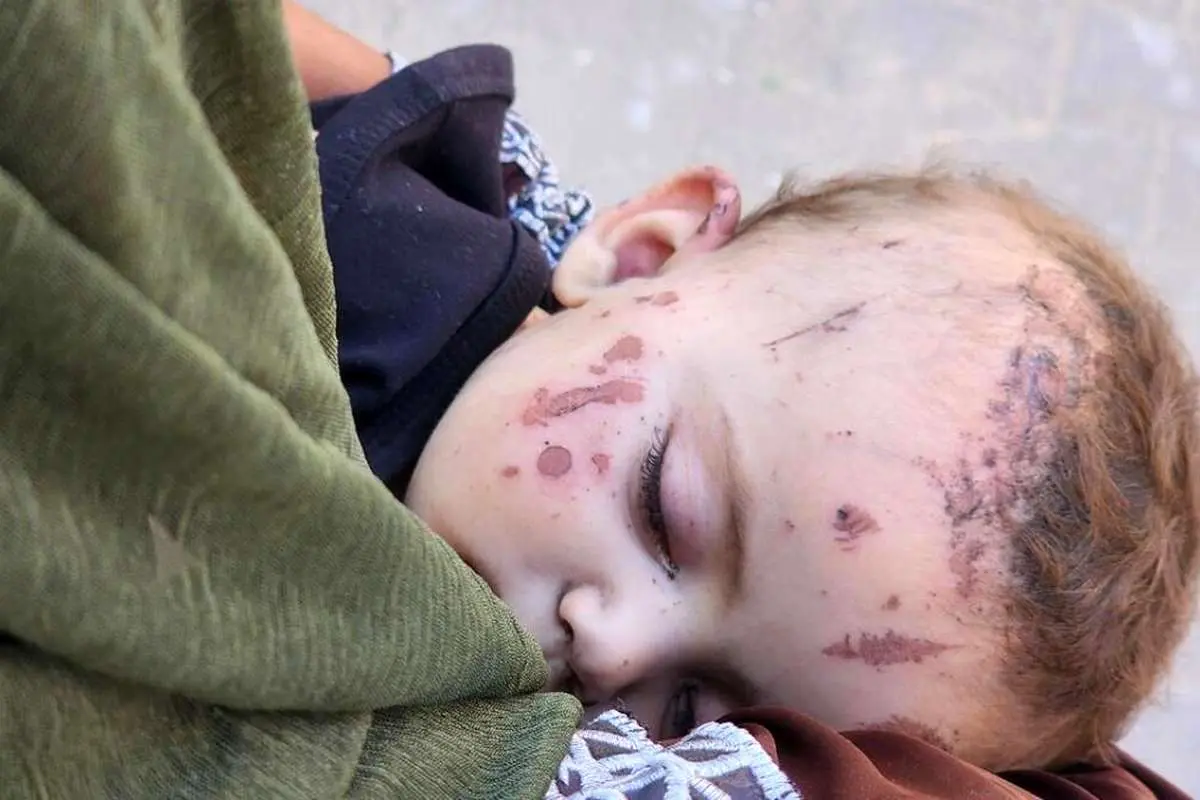 (تصاویر) نوزاد سه ماهه، تنها بازمانده قتلعام خانواده فلسطینی