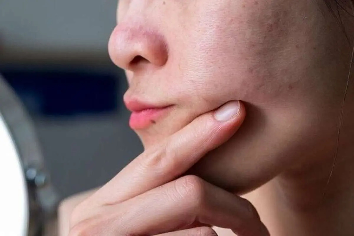 شما زشت نیستید، فقط استرس دارید!