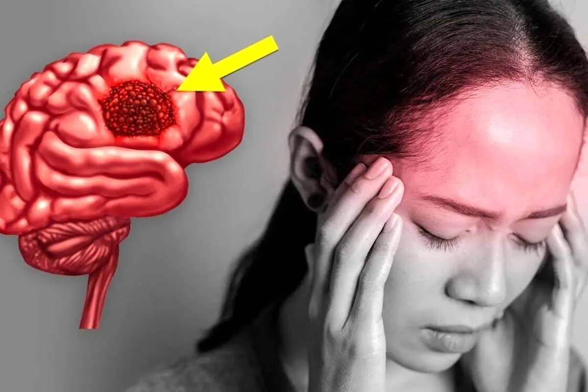 رابطه عجیب بین بزرگی شبکه قدامی مغز با افسردگی