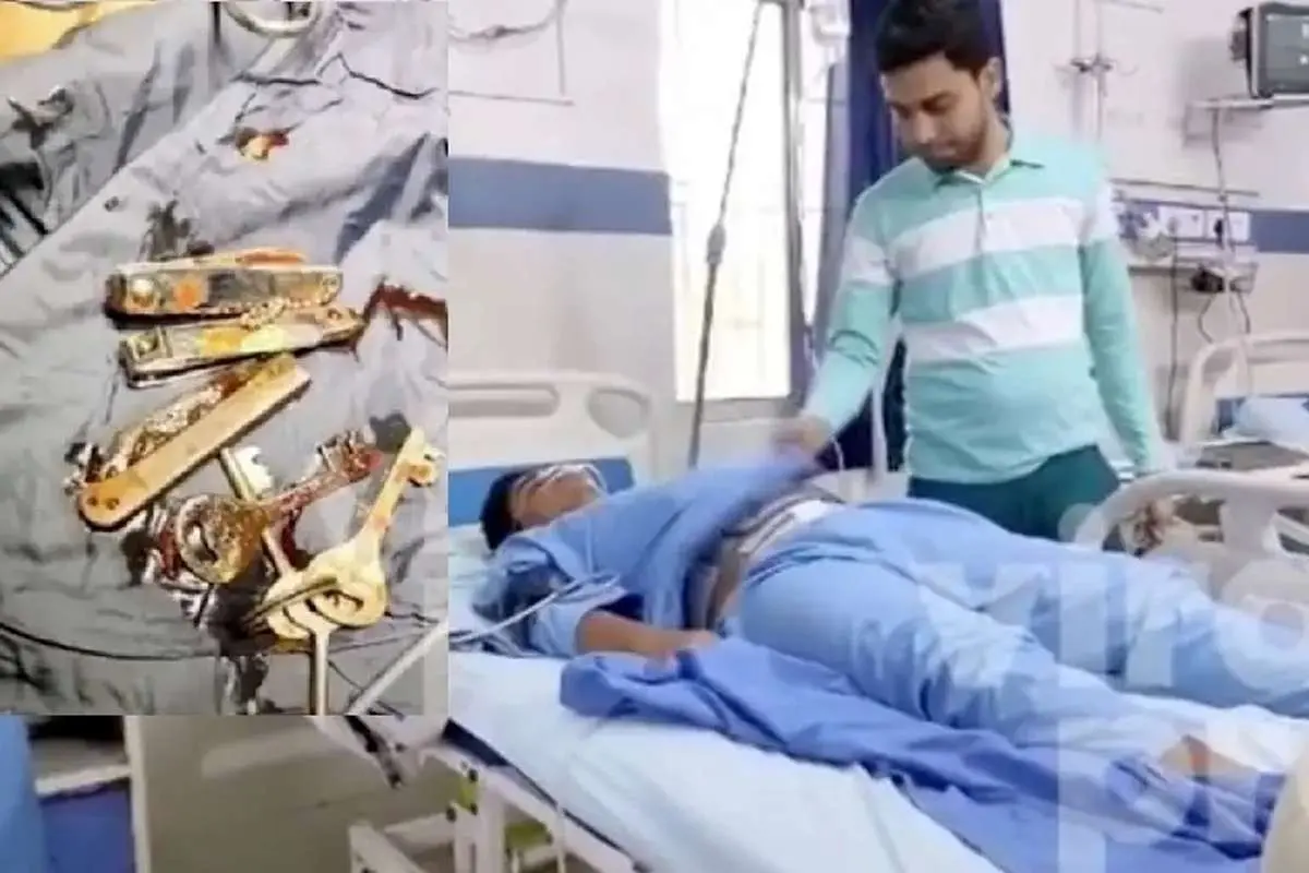 (ویدئو) پزشکان از شکم مردی جوان چند کلید، ناخنگیر و چاقو خارج کردند