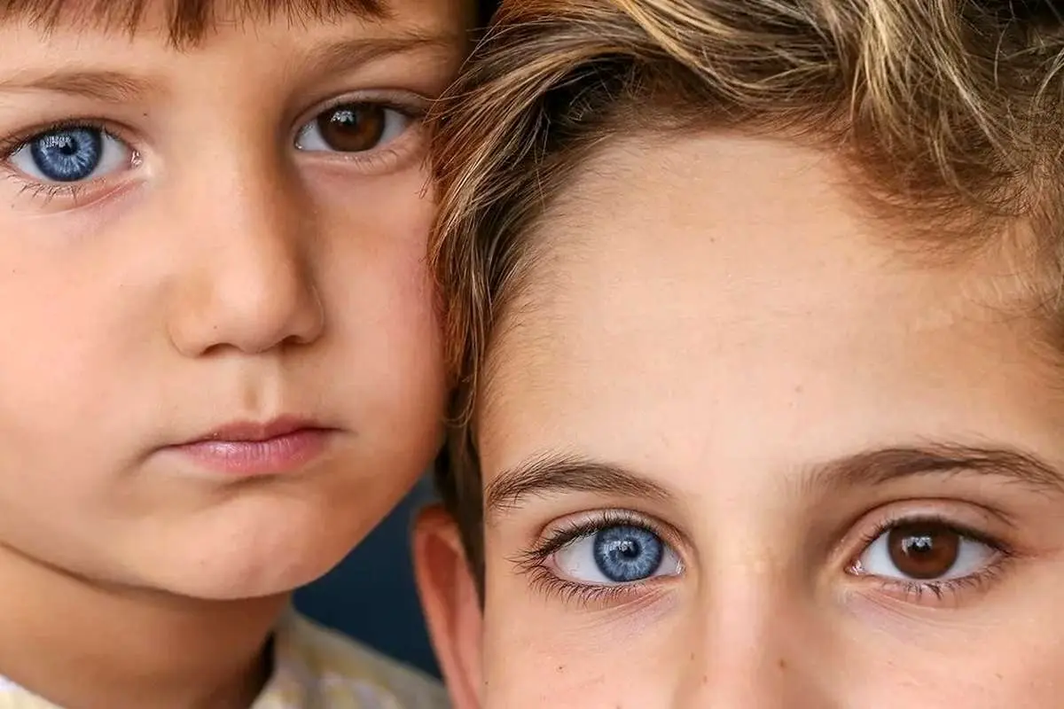 نادرترین رنگ چشم‌های جهان