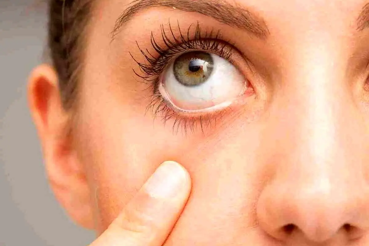 با خندیدن این بیماری چشمی را به سادگی درمان کنید