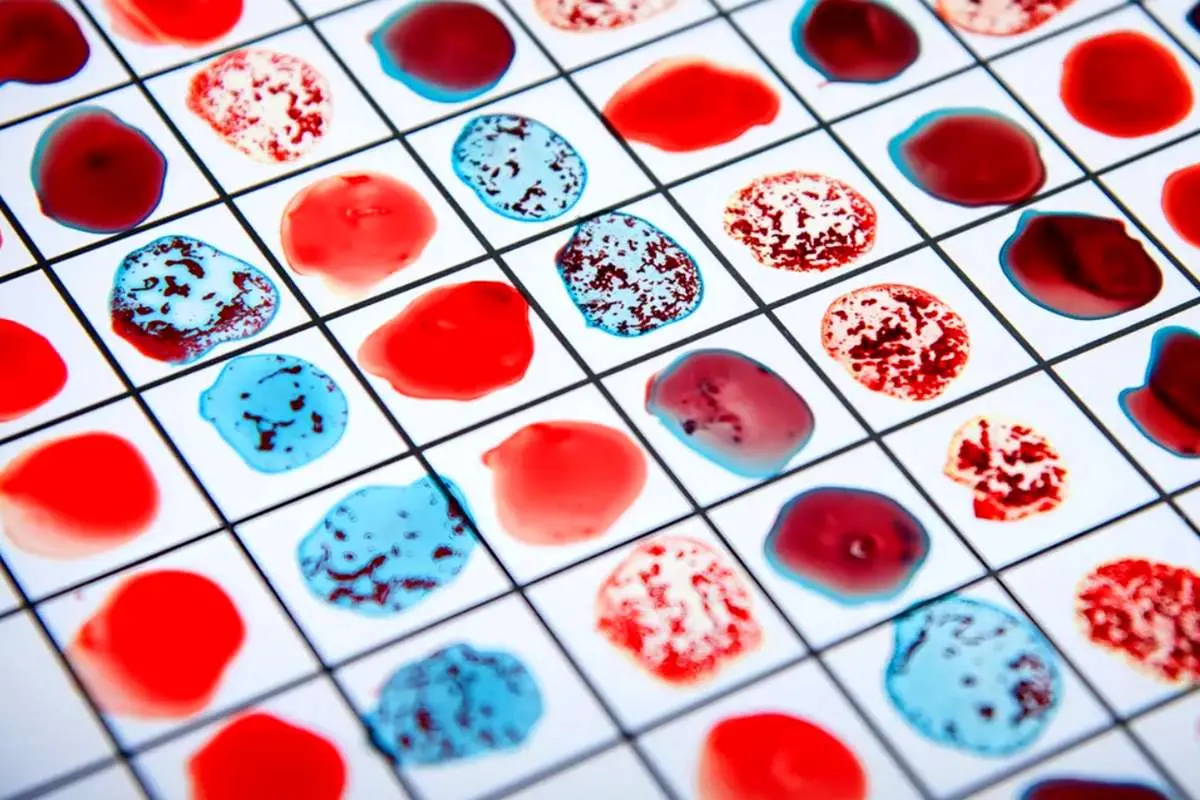 کشف یک گروه خونی جدید بعد از ۵۰ سال