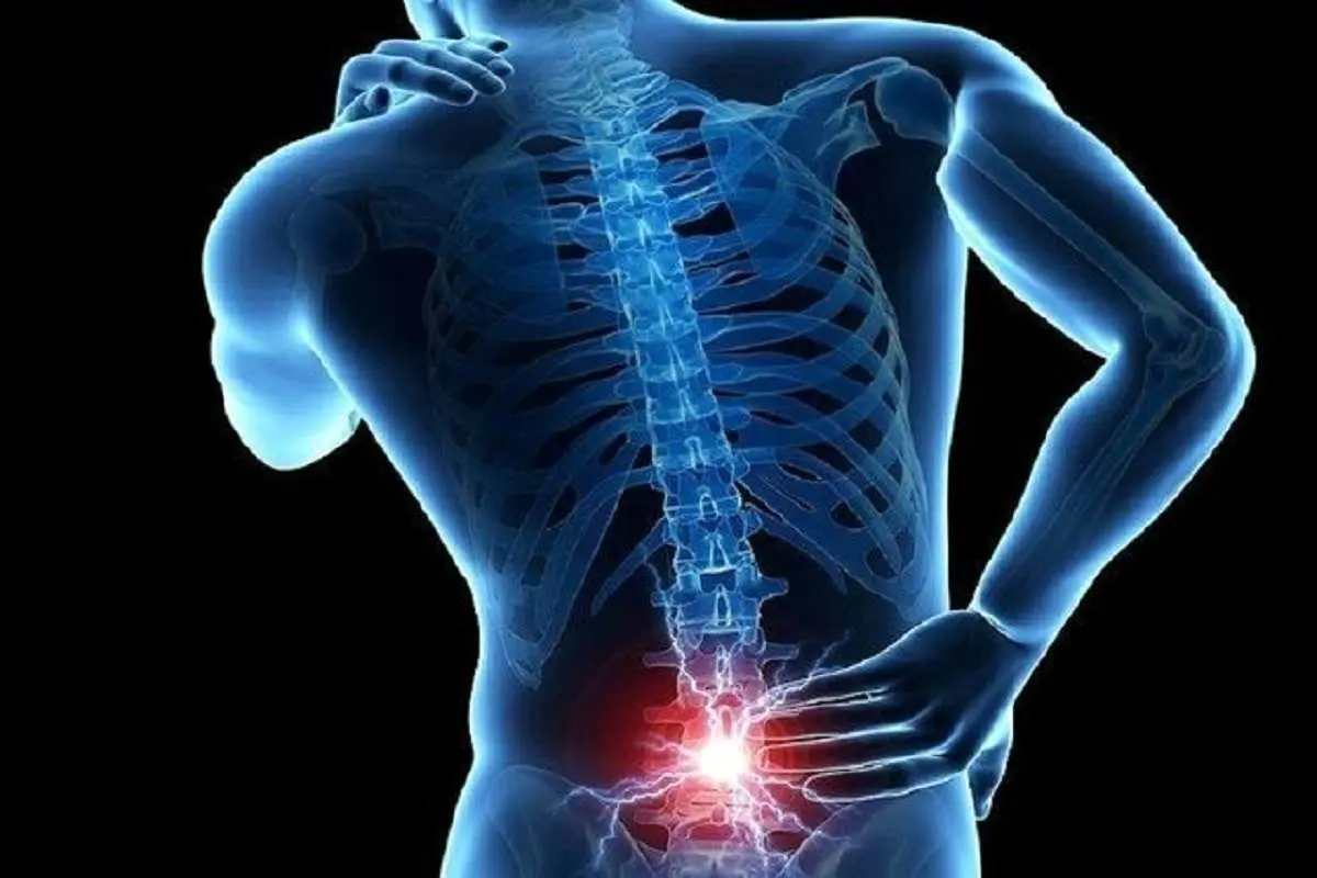 چرا پشت درد یا کمر درد میگیریم؟