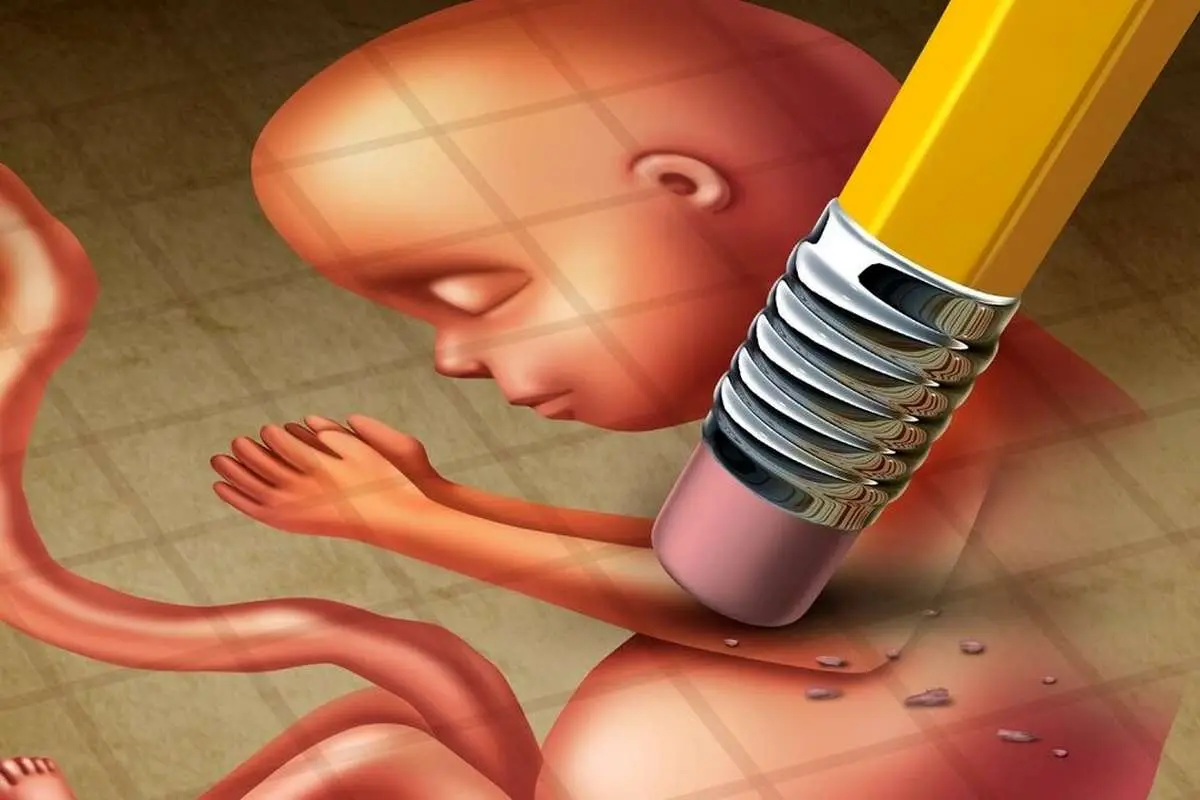 هزینه سقط جنین غیرقانونی در ایران ۱۵۰ میلیون تومان!