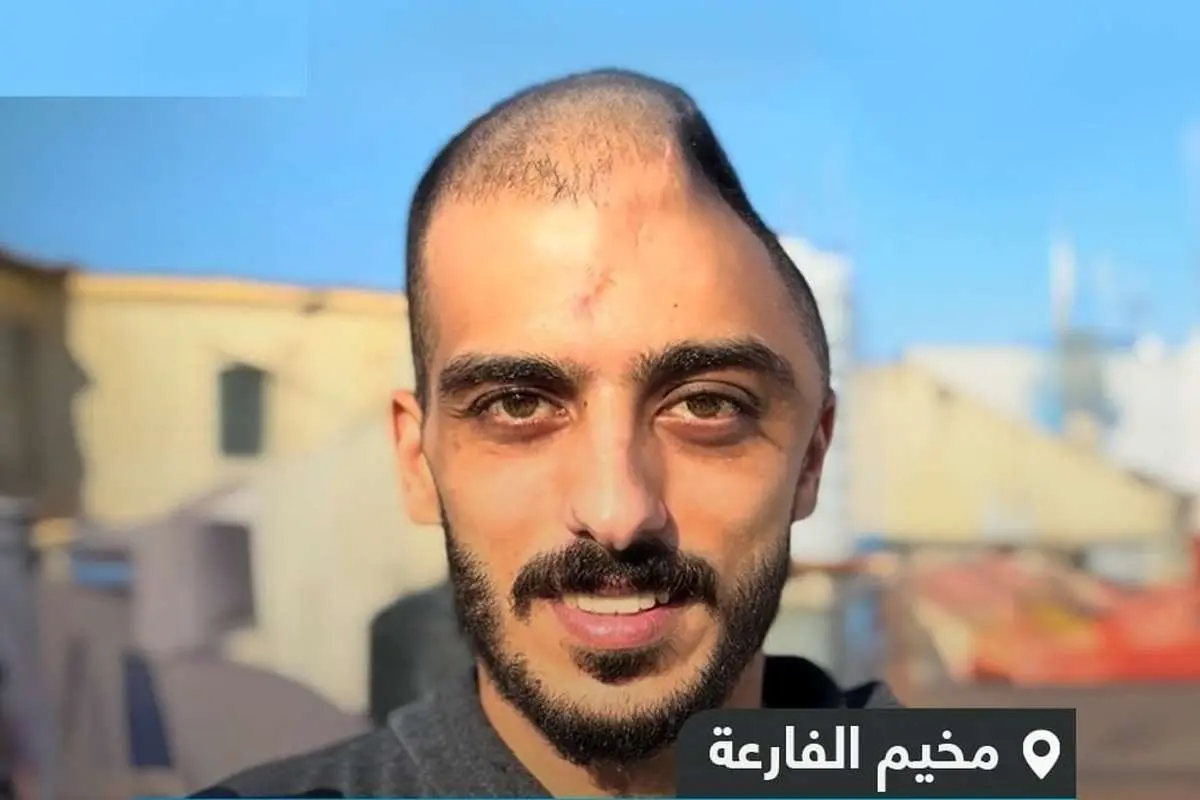 (ویدئو) جوان فلسطینی که نیمی از جمجمهاش را در حمله اسرائیل از دست داد