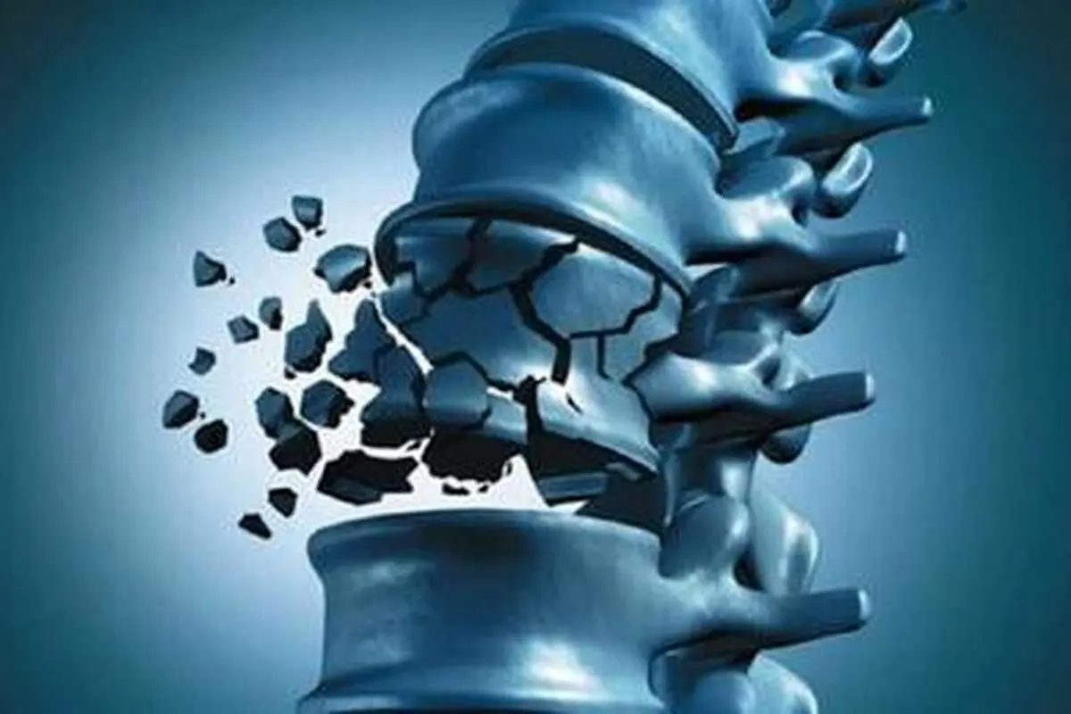 افزایش پوکی استخوان با مصرف این نوشیدنی گرم