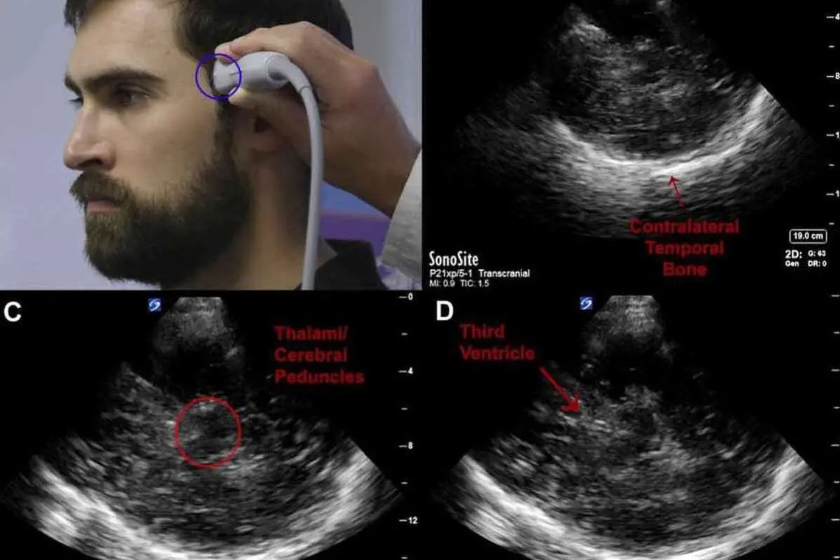 کشف یک روش جدید برای درمان اعتیاد