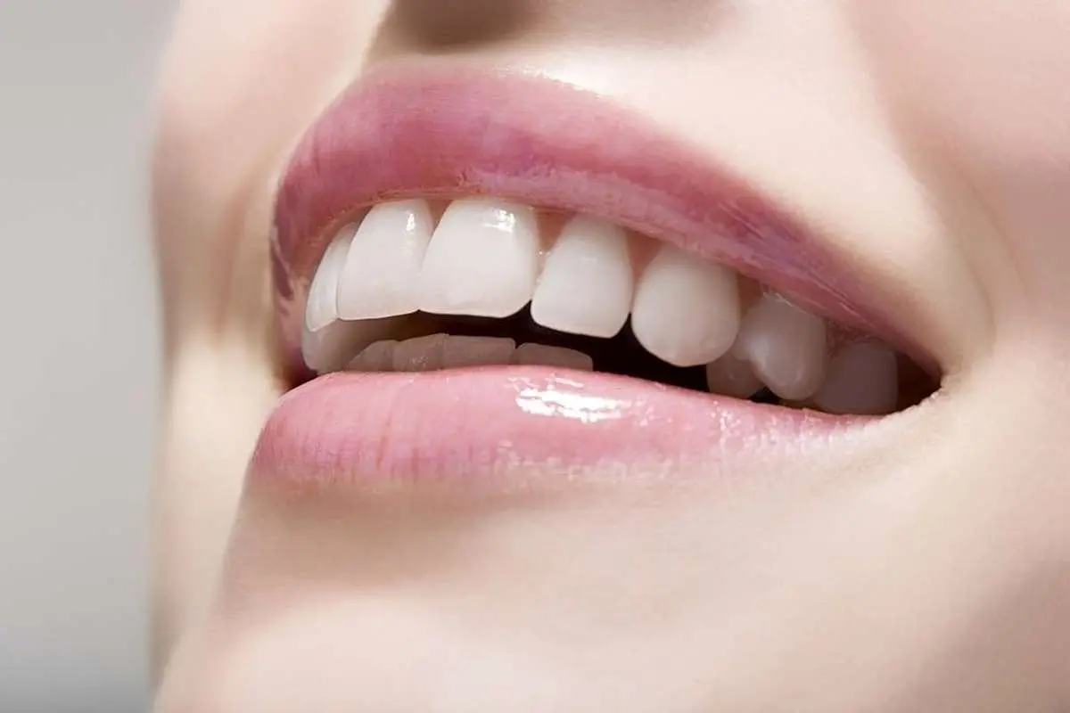 شش روش مفید برای سفید شدن دندانها