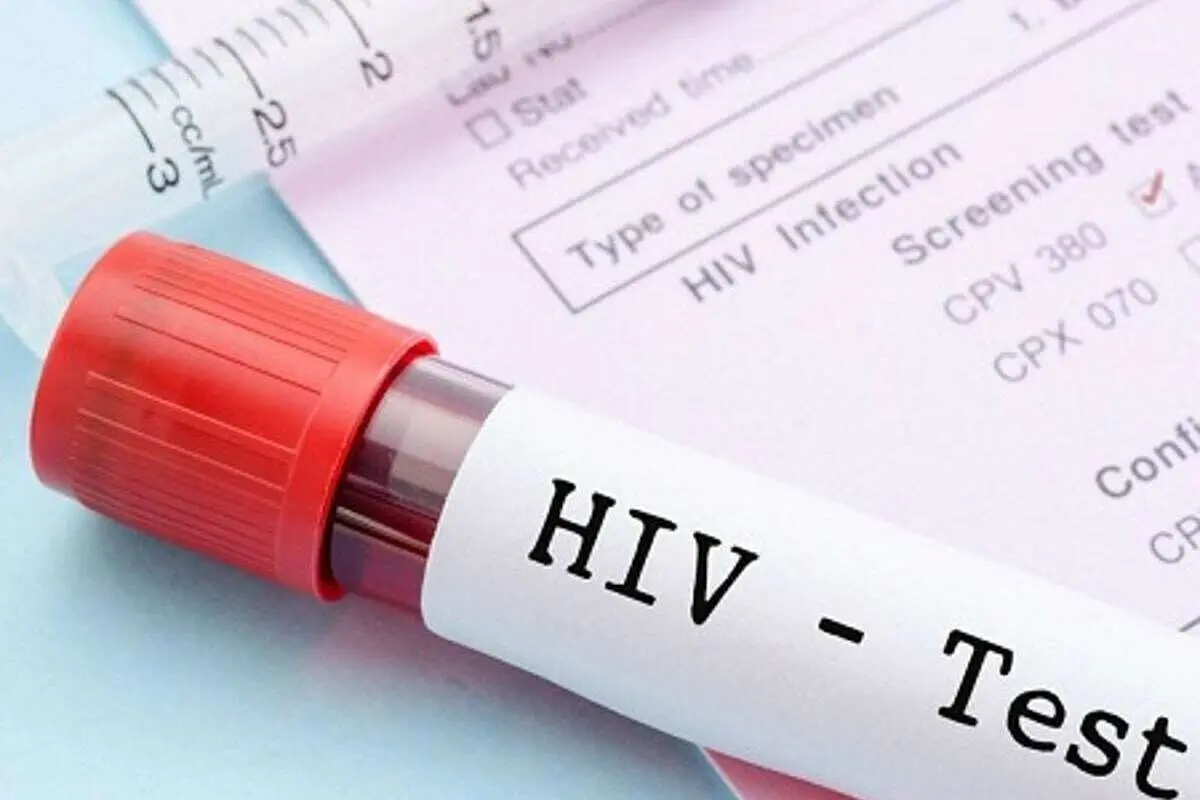 آزمایش رایگان و محرمانه HIV؛ جزییات مراکز تست اچآیوی