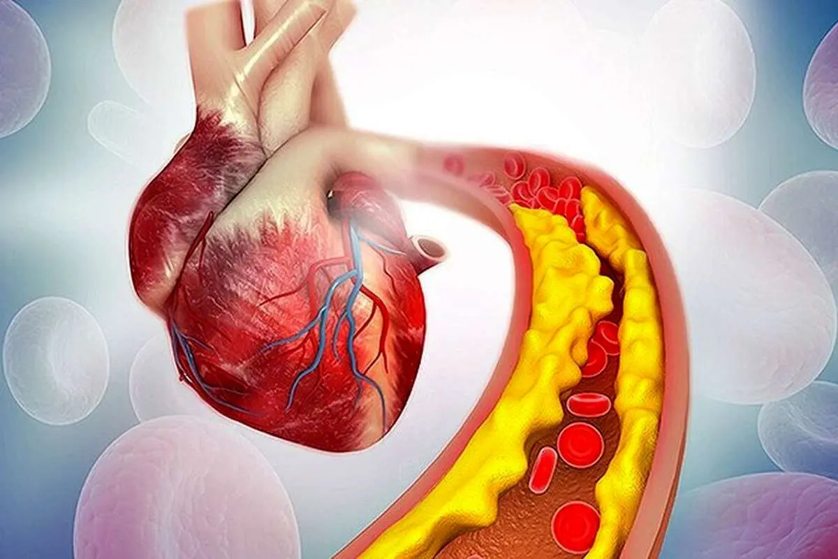 بدترین خوراکیها برای افزایش کلسترول خون کدامند؟