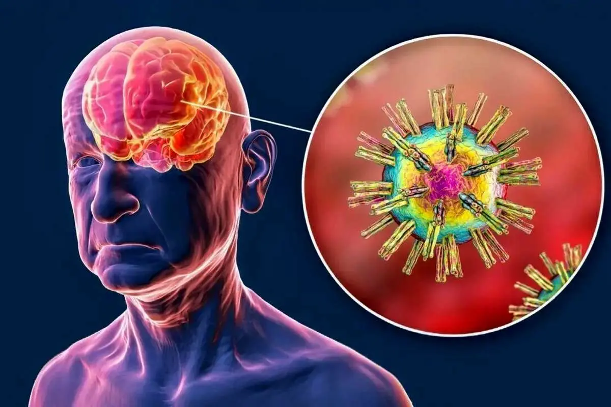 ویروس‌های خفته مغز را این حرکت بیدار می‌کند