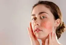 لکه‌های قرمز روی پوست نشانه کمبود کدام ویتامین است؟