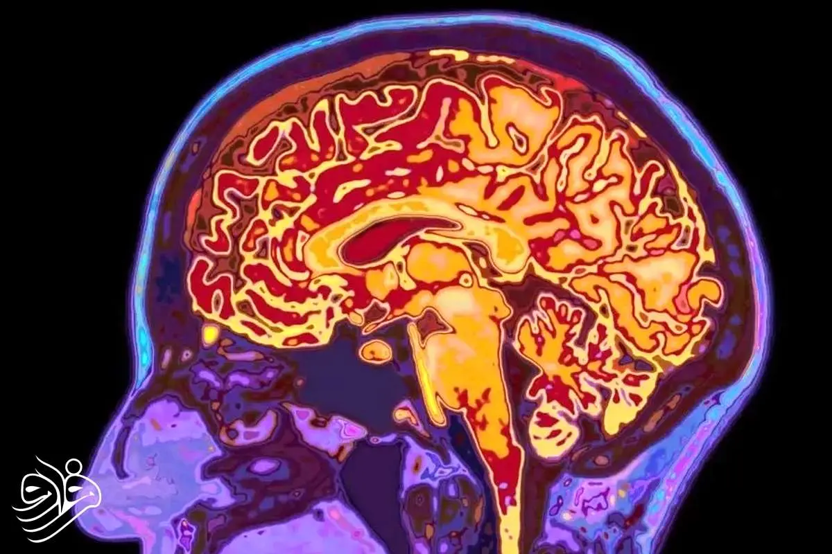 چرا مغز تا ۳۲ سالگی مثل یک نوجوان رفتار می‌کند؟