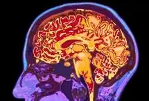 چرا مغز تا ۳۲ سالگی مثل یک نوجوان رفتار می‌کند؟