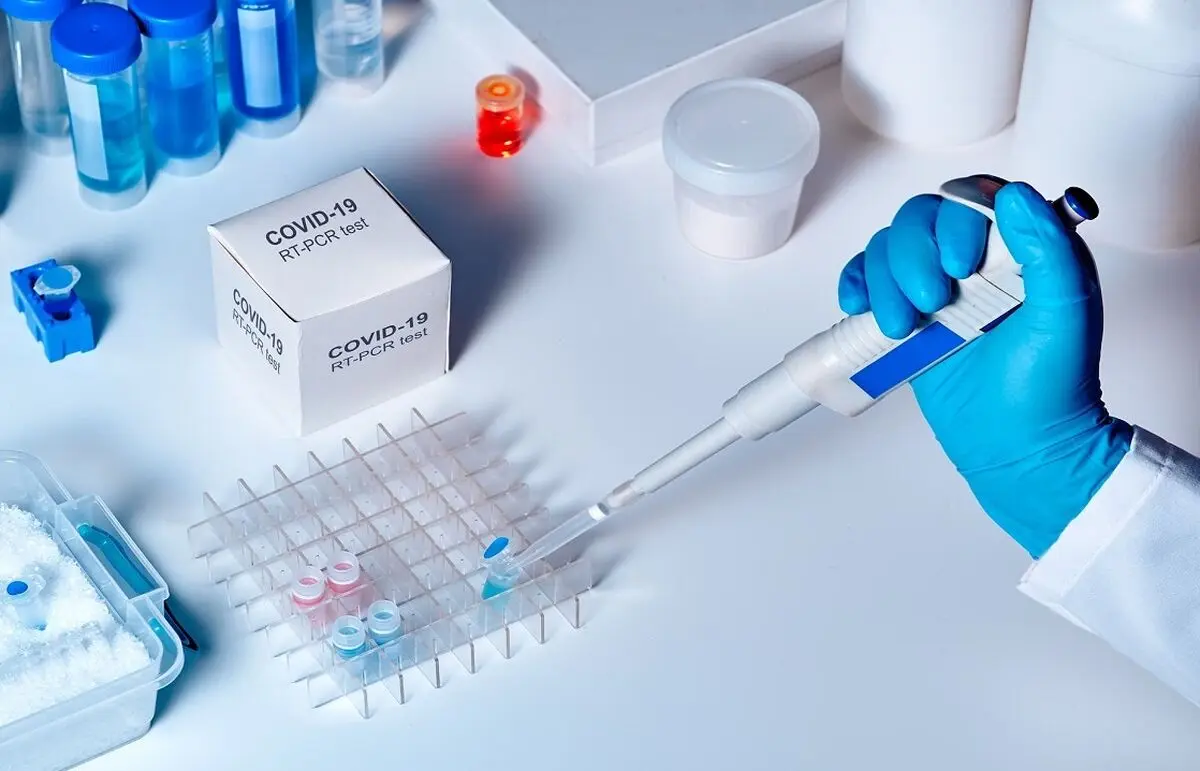 حذف برخی آزمایش‌ها به دلیل نبود کیت تشخیصی