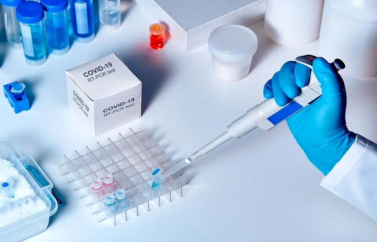 حذف برخی آزمایش‌ها به دلیل نبود کیت تشخیصی