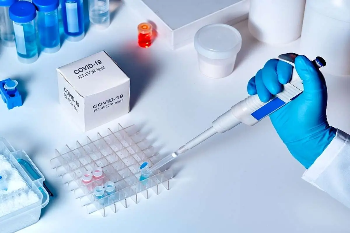 حذف برخی آزمایشها به دلیل نبود کیت تشخیصی