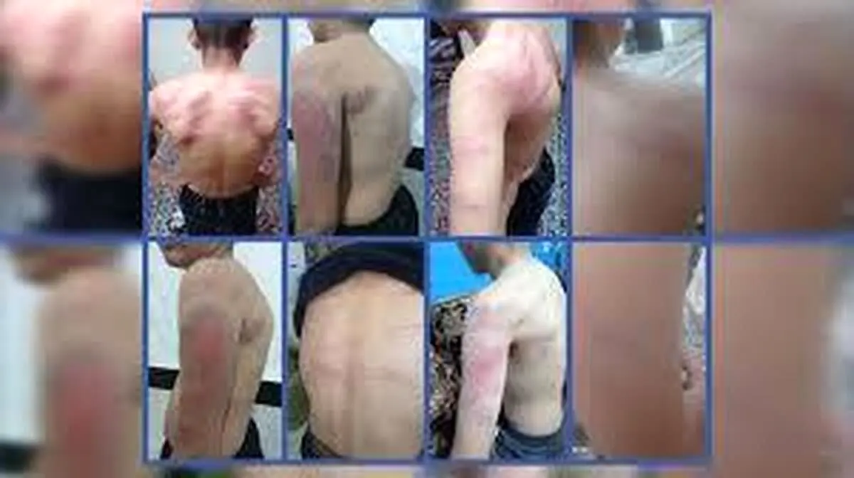 شکنجه‌ ۱۳ دانش‌آموز توسط معلم به ‌دلیل گم‌شدن شارژر