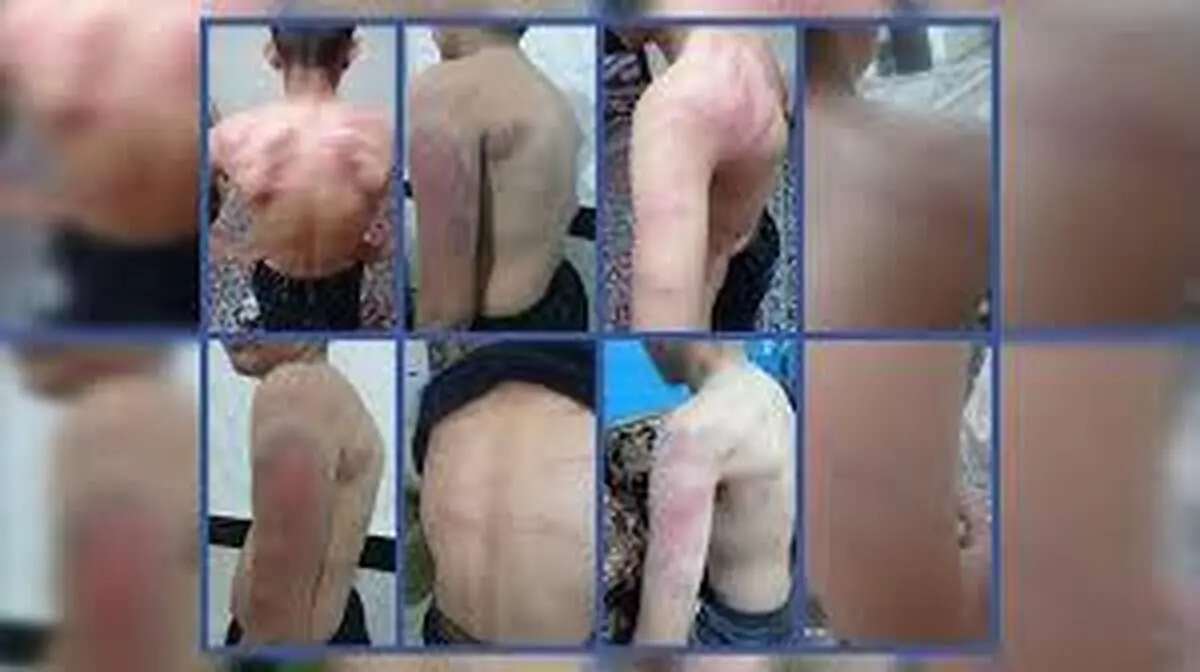 شکنجه‌ ۱۳ دانش‌آموز توسط معلم به ‌دلیل گم‌شدن شارژر