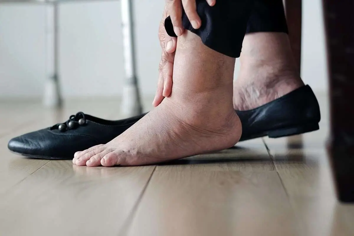 پای متورم؛ نشانهای از خستگی یا زنگ خطری برای قلب؟