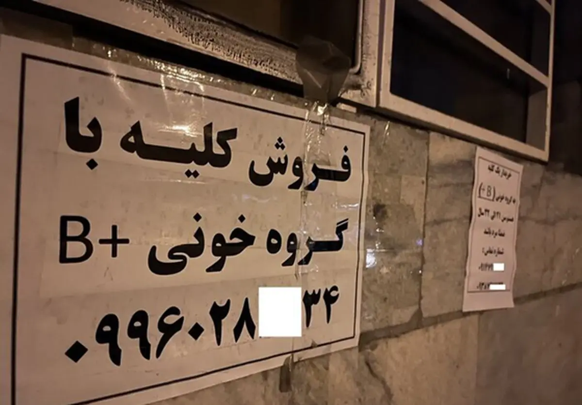 جزییات تکان‌دهنده از فروش کلیه ۷۰میلیاردی در تهران!