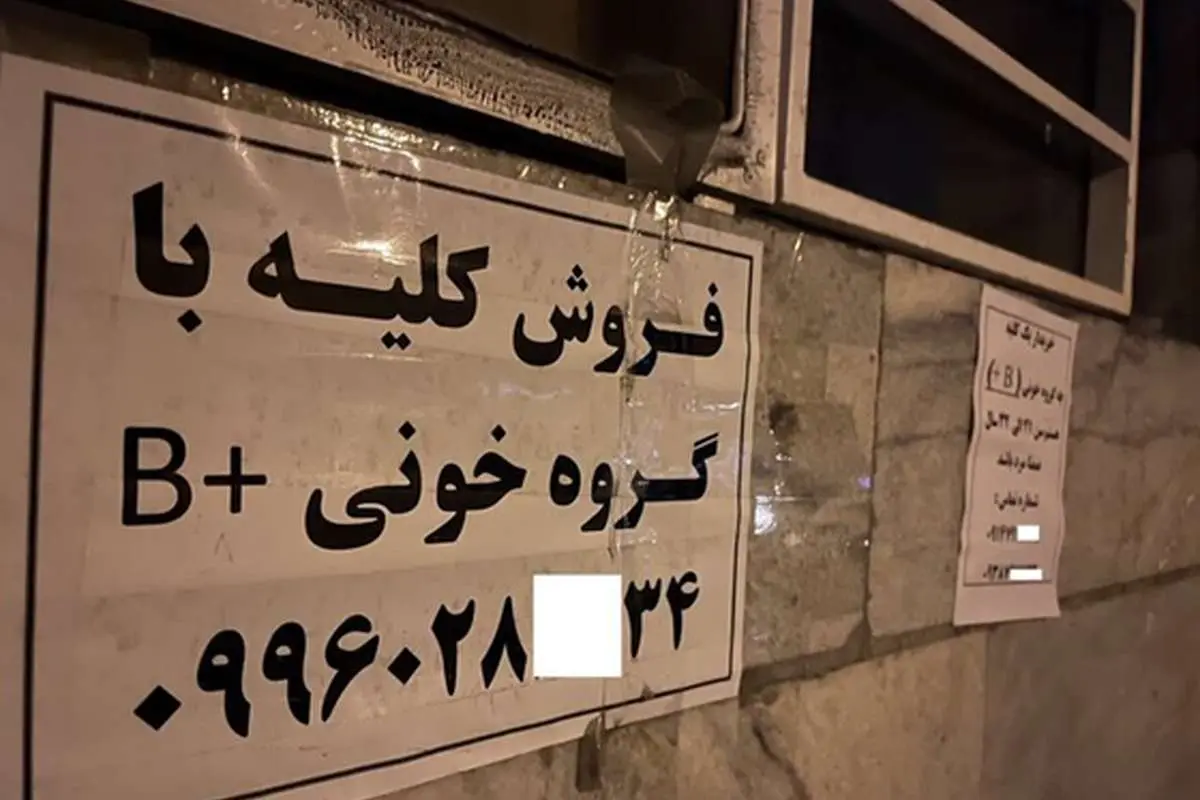 جزییات تکاندهنده از فروش کلیه ۷۰میلیاردی در تهران!