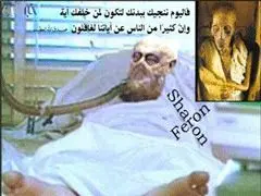 تصویر آریل شارون در کما