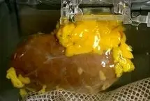 دانشمندان کلیه ای ساختند که با همه گروه های خونی سازگار است